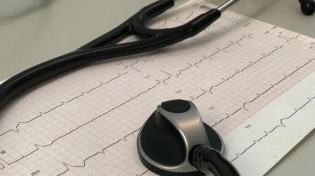 Un electrocardiograma