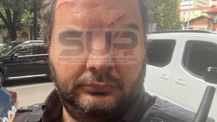 Imagen de uno de los agentes heridos