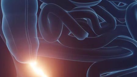 El apéndice es una pequeña bolsa con forma de dedo que se encuentra donde el intestino delgado se une al intestino grueso, en el ciego