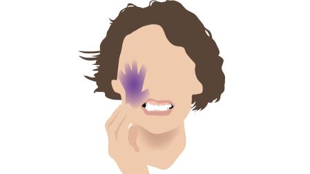 Ilustración con una mujer y la mano morada, símbolo de la violencia de género