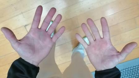 Las manos de Joseba Ezkurdia, tras la pasada final del Parejas.