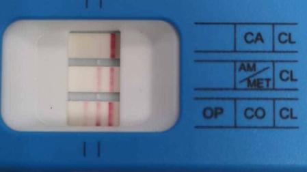 Test de drogas al que se sometió el conductor que se dio a la fuga en Carcastillo
