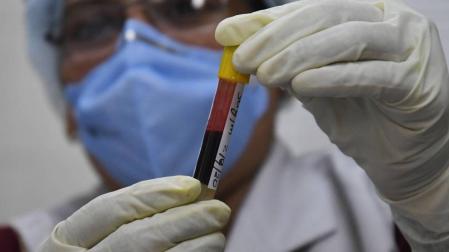 El plasma hiperinmune podría reducir los ingresos en UCI o fallecimientos por covid