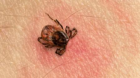 Picadura de garrapata e infección