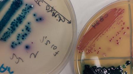 Placas de petri con cultivos de bacterias resistentes a antibióticos aisladas de pacientes. En azul puede observarse a ‘Klebsiella pneumoniae’, y en rojo, a ‘Escherichia coli’