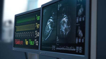 Un monitor registra la frecuencia cardiaca