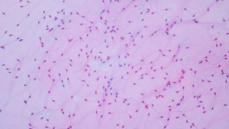Vista de esperma humano al microscopio