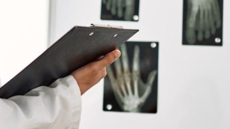 Unas radiografías expuestas en una consulta