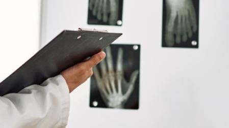 Radiografías en una consulta