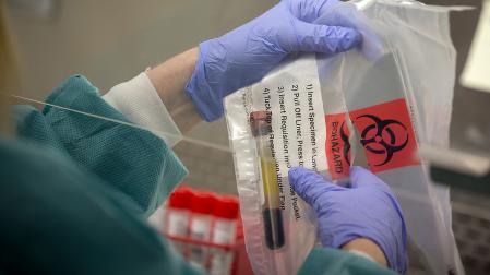 Foto de archivo de un técnico de laboratorio del departamento de salud de Minnesota en Estados Unidos con tubos de saliva de pacientes para testarla por sarampión.