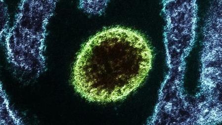 Imagen de archivo del virus Nipah