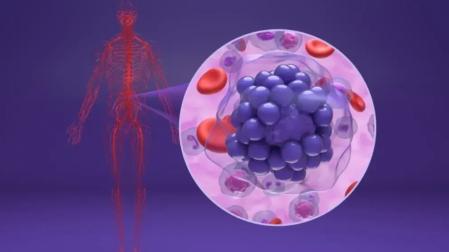 La molécula microARN miR-28 reduce resistencia a ibrutinib, fármaco empleado en un tipo agresivo de linfoma de células B