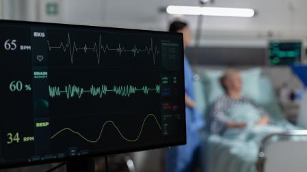 Imagen de archivo de un cardiograma