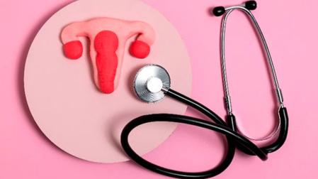 Imagen de archivo representativa del cáncer de ovarios