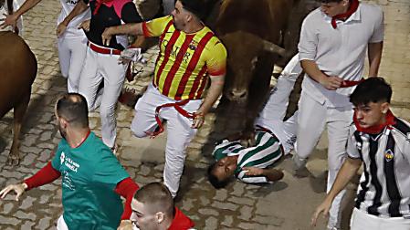 Foto del pisotón que ha dejado en la UCI a un corredor del cuarto encierro de San Fermín 2026
