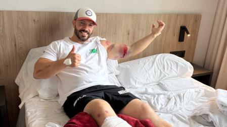 Ander Etxanobe Iturri con la pierna derecha vendada, en el hotel donde se aloja estos Sanfermines
