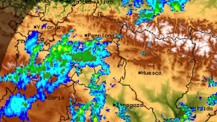 Radar