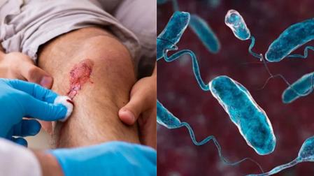 Bacteria 'come carne'