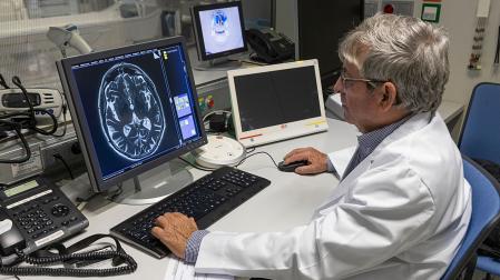 La nueva técnica de procesamiento de resonancia magnética permite visualizar con más claridad la lesión cerebral producida mediante HIFU para tratar el temblor.