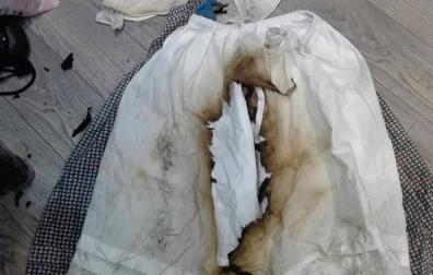 Una niña sufre quemaduras al arder su vestido en una tienda de Pamplona