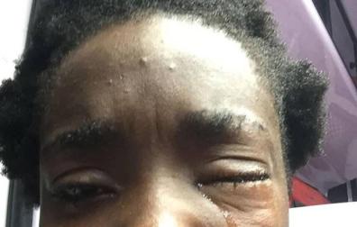 Las agresiones a extranjeros disparan "la alarma racismo" en Italia