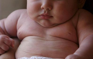 España, a la cabeza de la obesidad infantil en Europa