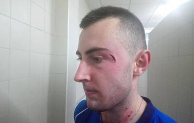 Susto y costurón para Bakaikoa en el telonero