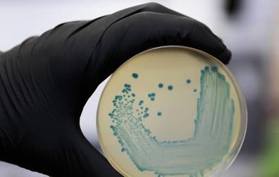 Imagen de un cultivo de la bacteria listeria.