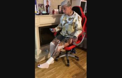 Chimy Ávila ya hace ejercicios con su rodilla izquierda.