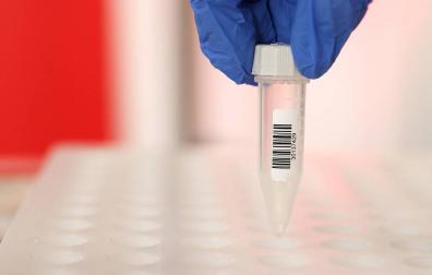 Sanidad confirma la reducción de contagios a 84 en las últimas 24 horas