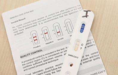 Navarra incorpora los test rápidos a urgencias hospitalarias