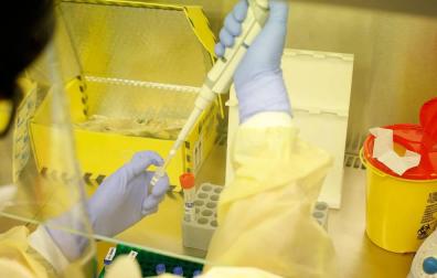 Análisis de coronavirus en el laboratorio del CHN.