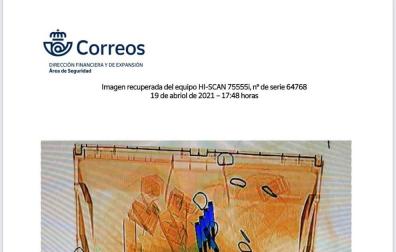 Imagen del escáner con las balas.
