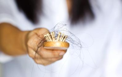Pérdida de pelo