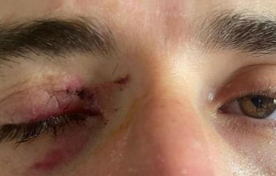 Así ha quedado el ojo de Karim Ansarifard
