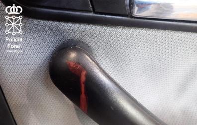Restos de sangre en el interior del coche