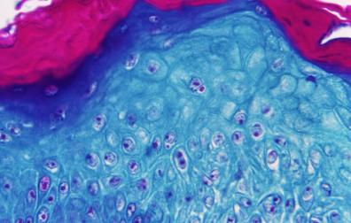 Imagen ampliada con un microscopio de una muestra de piel de un mono infectado con el virus de la viruela del mono
