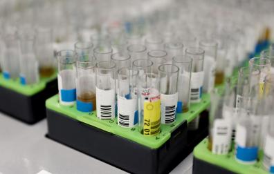 Hospital Gregorio Marañón donde realizan PCR para la viruela del mono