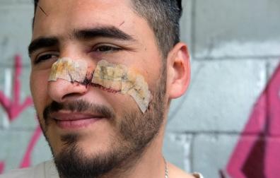 Amin sufrió un corte de ocho centímetros con una profundidad hasta el hueso del pómulo.