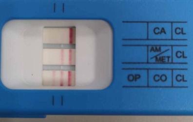 Test de drogas al que se sometió el conductor que se dio a la fuga en Carcastillo