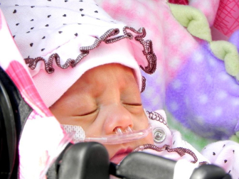 Una bebé hispana que nació 16 semanas antes de lo previsto, considerada una de las bebés más pequeñas del mundo en sobrevivir, fue dada de alta hoy de un hospital de Los Ángeles. Melinda Star Guido nació el 30 de agosto pasado, a las 24 semanas de gestación, pesando sólo 9,5 onzas (269 gramos) (menos que una lata de bebida gaseosa), y hoy al ser dada de alta del Centro Médico LAC+USC pesó 4,5 libras (454 gramos). EFE (EE.UU)