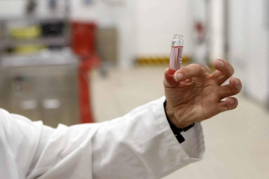 Las últimas alertas en el país por listeria o bolutismo, hallado en este último caso en un lote de atún envasado, avivan el interés por conocer los recursos de prevención y protocolos de seguridad alimentaria