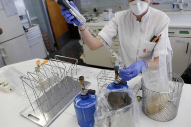 Las últimas alertas en el país por listeria o bolutismo, hallado en este último caso en un lote de atún envasado, avivan el interés por conocer los recursos de prevención y protocolos de seguridad alimentaria