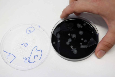 Las últimas alertas en el país por listeria o bolutismo, hallado en este último caso en un lote de atún envasado, avivan el interés por conocer los recursos de prevención y protocolos de seguridad alimentaria