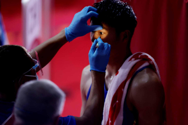 Atienden al boxeador chino