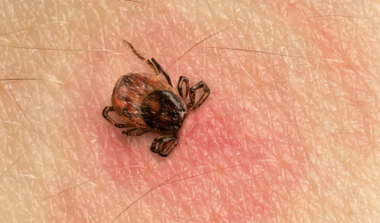 Picadura de garrapata e infección