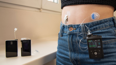 Modelos de sistemas integrados para la diabetes tipo 1 empleados actualmente en el SNS