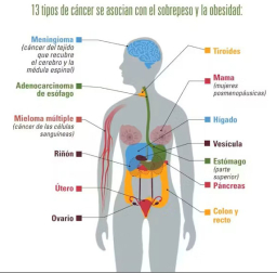 Cánceres asociados a la obesidad