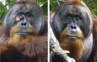 Rakus es un orangután macho de Sumatra (Pongo abelii) que sufrió una herida debajo de uno ojo y sobre la que se aplicó una planta de conocidas propiedades medicinales, un comportamiento que es la primera vez que se observa en un animal salvaje