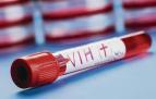 El Parlamento foral concretará un pacto político para "prevenir y combatir el VIH-Sida"